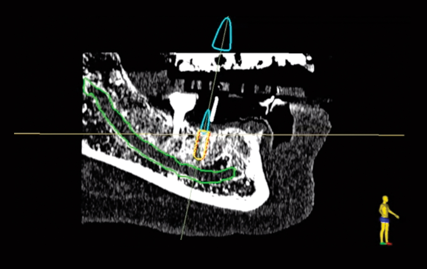 Medical Navigation - Surgical Precision System